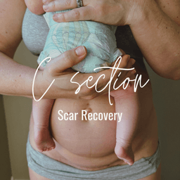 C Section Scar Recovery