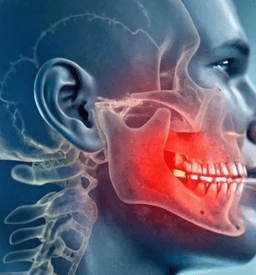 TMJ Relief and Jaw Mobility