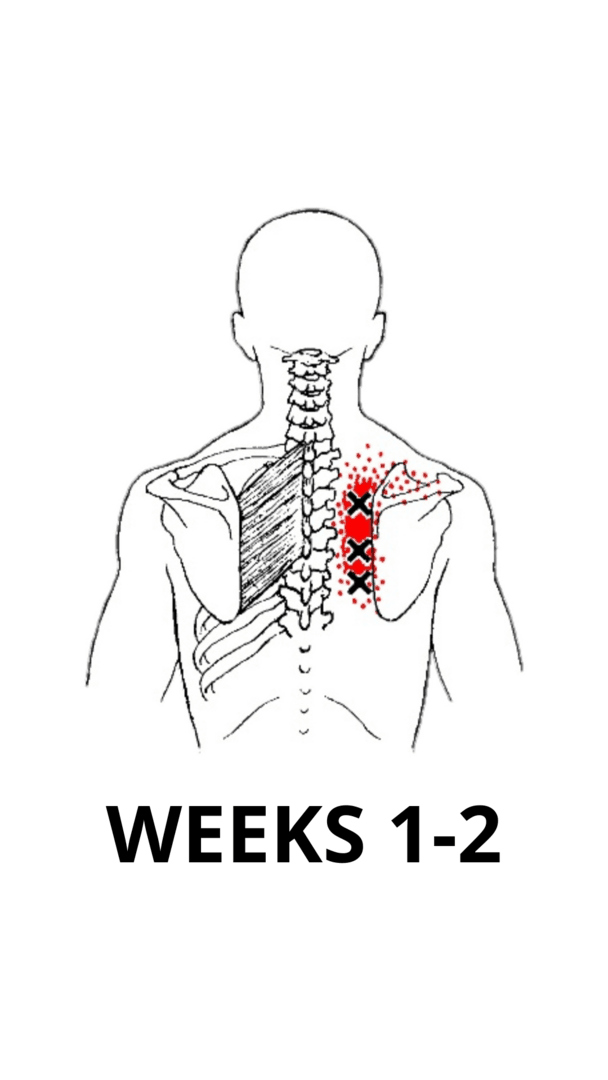 Neck and Shoulder Blade Recovery - Weeks 1-2
