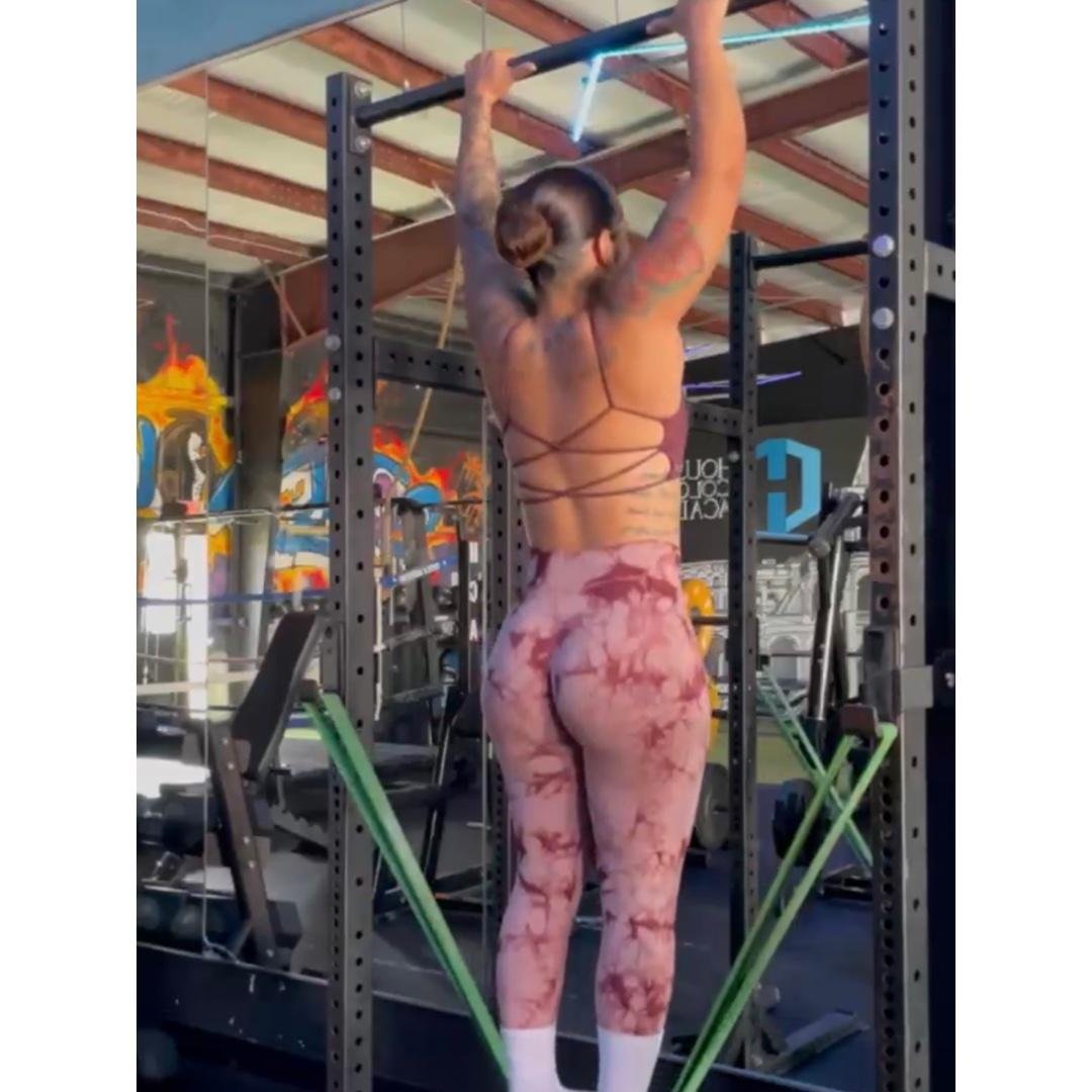 Upper body burn