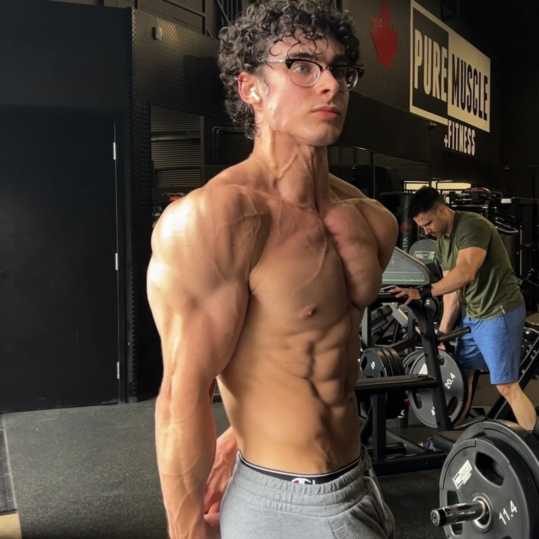 TRICEPS