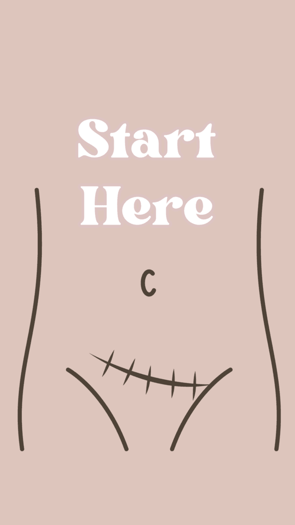 C-section Protocol Welcome
