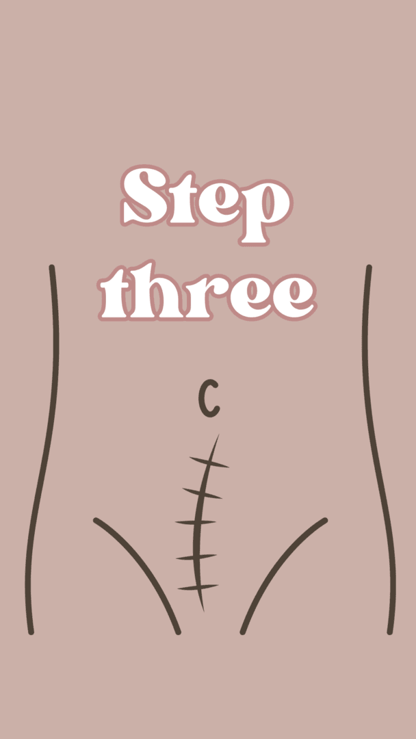 Muscle layer: Step 3