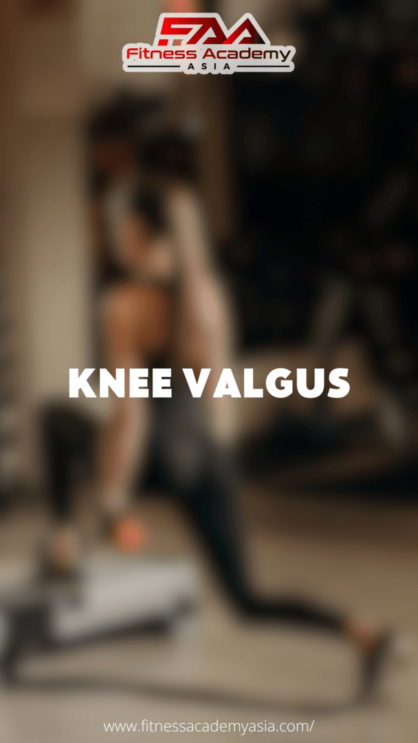 Đầu gối đỏ trong - Knee Valgus